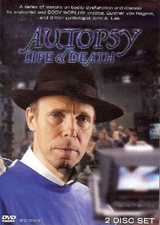 Omslag van Autopsy Life & Death 